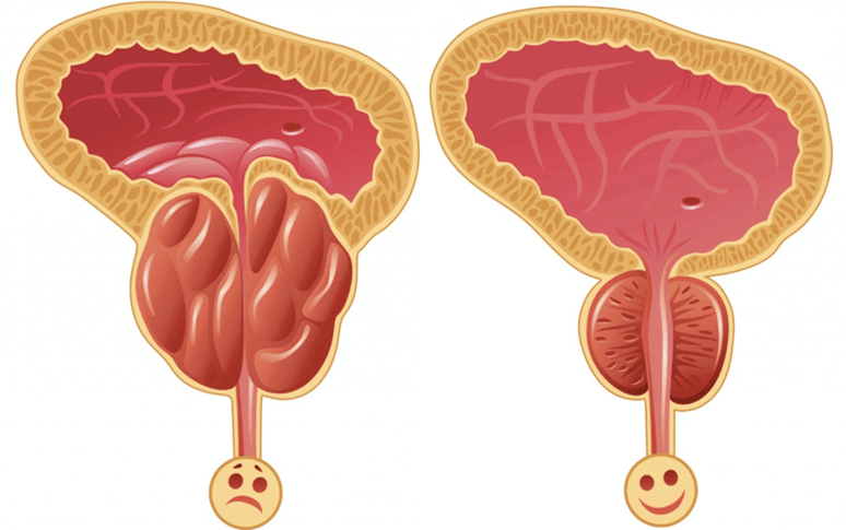 causas de problemas de potência em homens